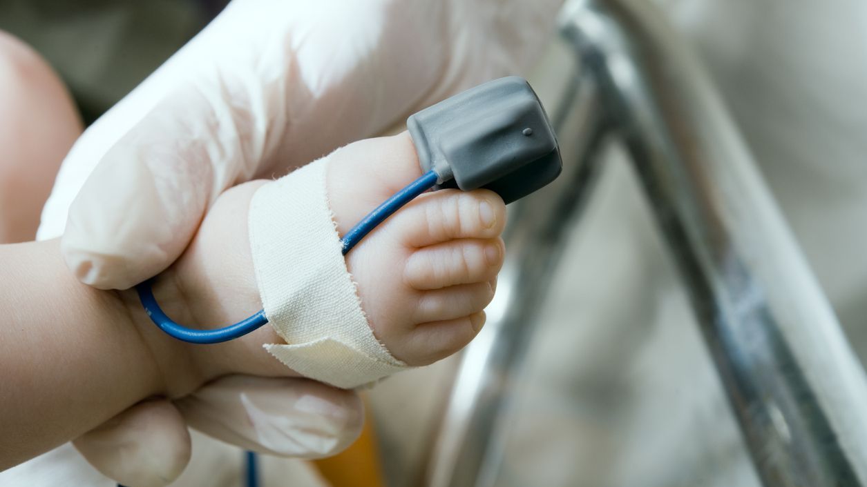 A pulse oximeter on a baby's foot Pulse oximetry screening